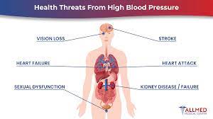 Understanding the Risks of High Blood Pressure